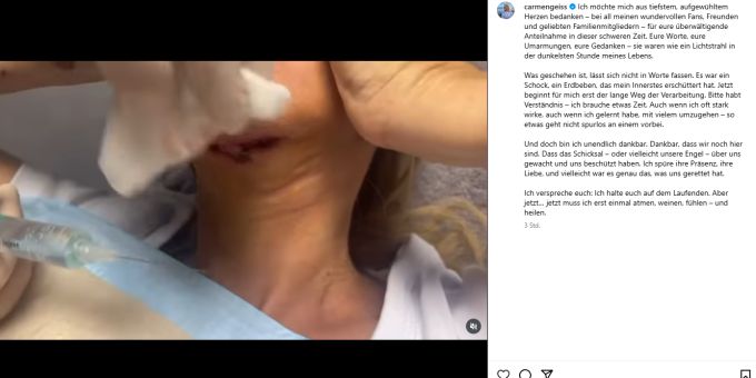Carmen Geiss wurde gewürgt und erlitt eine Schnittwunde am Hals. Geissens