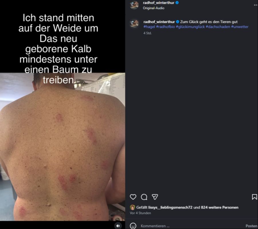 Auch der Rücken des Bio-Bauern ist übersät mit Hagelverletzungen.