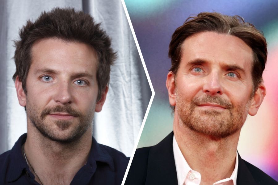 Beauty-Expertin Alexandra Lüönd ist sich sicher, dass sich der Schauspieler Bradley Cooper unter das Messer gelegt hat.