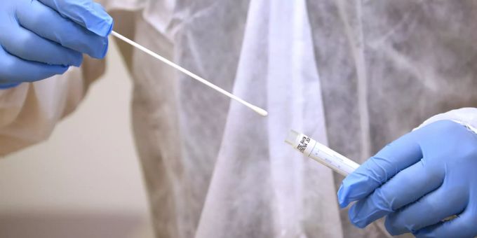 Ein Arzt hält einen Tupfer mit einem Abstrich für einen Test für das Coronavirus. bremse gesundheitsdirektoren