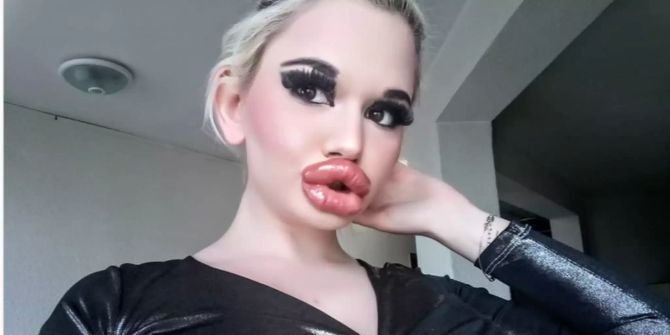 Lippe