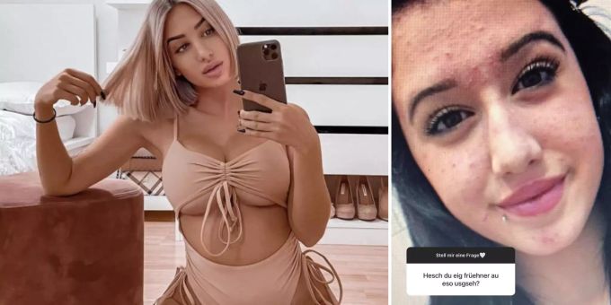 Krasser Beauty-Wandel - «Bachelor»-Siegerin Franci teilt Teenie-Bild