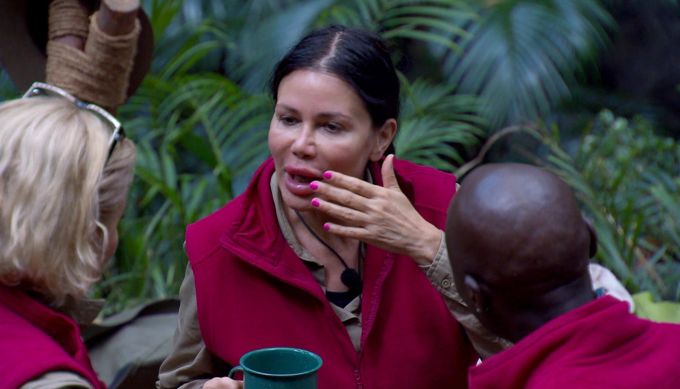 Im Dschungelcamp erzählt Djamila lustige Geschichten über ihre Lippen. Dschungelcamp