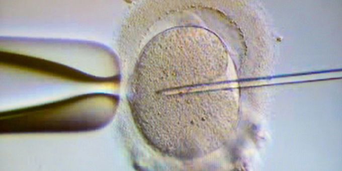 Bei einer Intrazytoplasmatische Spermieninjektion (ICSI) wird einer Eizelle ein Spermium injiziert. Bei einer Intrazytoplasmatische Spermieninjektion (ICSI) wird einer Eizelle ein Spermium injiziert.
