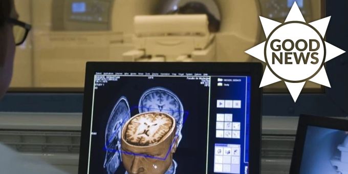 Good News - Forscher entwickeln Impfstoff gegen Krebszellen
