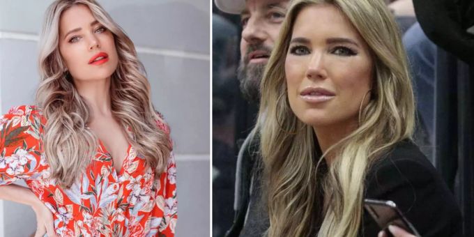 «Heftig und tut weh» - Sylvie Meis spricht über Hass nach Beauty-Fail