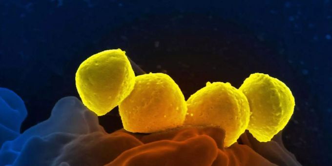 Ein neu entwickelter Verband tötet antibiotikaresistente Bakterien (gelb) in Wunden ab.