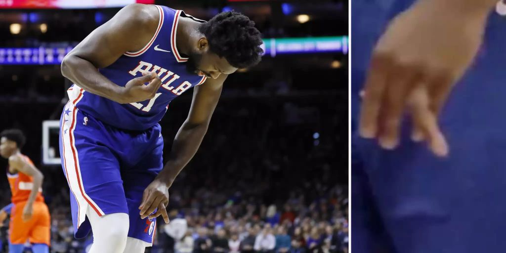 NBA Philadelphias Joel Embiid kugelt sich den Finger aus