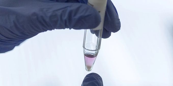Handystrahlung ist nicht zwangsläufig der Grund für die tiefe Spermienqualität bei Männern - und auch kein zwingender Indikator für die Fruchtbarkeit. Männer sollten sich keine Sorgen machen, so die Biologin Rita Rahban von der Universität Genf. (Symbolbild) Handystrahlung ist nicht zwangsläufig der Grund für die tiefe Spermienqualität bei Männern - und auch kein zwingender Indikator für die Fruchtbarkeit. Männer sollten sich keine Sorgen machen, so die Biologin Rita Rahban von der Universität Genf. (Symbolbild)