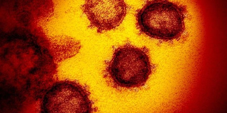 Die vom National Institute of Allergy and Infectious Diseases zur Verfügung gestellte Elektronenmikroskopaufnahme zeigt das Coronavirus SARS-CoV-2, das von einem Patienten in den USA isoliert wurde und aus der Oberfläche von im Labor kultivierten Zellen austritt. Foto: Niaid-Rml/ZUMA Wire/dpa