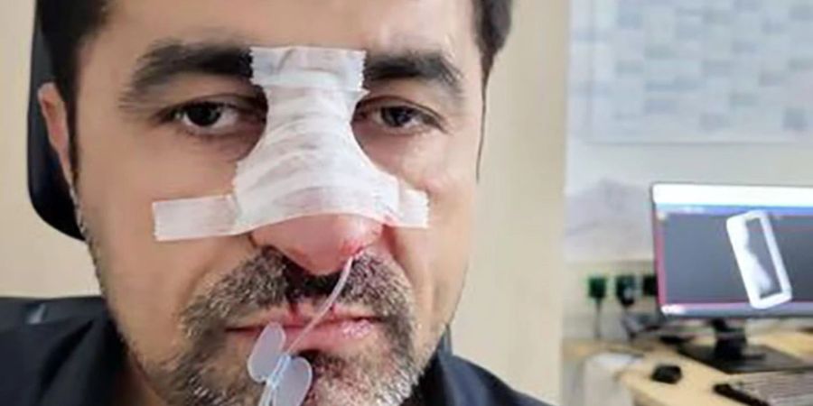 Der verletzte SPD-Stadtrat Halil Tasdelen.