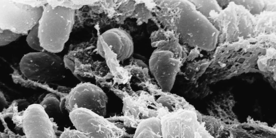 Eine Elektronenmikroskopaufnahme des Pesterregers Yersinia pestis. Forschende haben rekonstruiert, wie das Bakterium im 17. Jahrhundert in Venedig grassierte. (Archivbild)