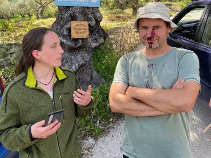 Nach dem Angriff der Wilderer: Camp-Leiter Bostjan Debersek mit kaputter Nase. onlinereports
