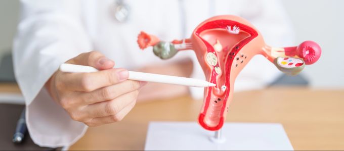 Wer regelmässig zur Frauenärztin oder zum Frauenarzt geht, kann Eierstockkrebs frühzeitig entdecken lassen. Frauengesundheit