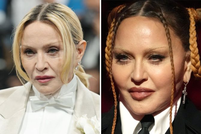 Madonna