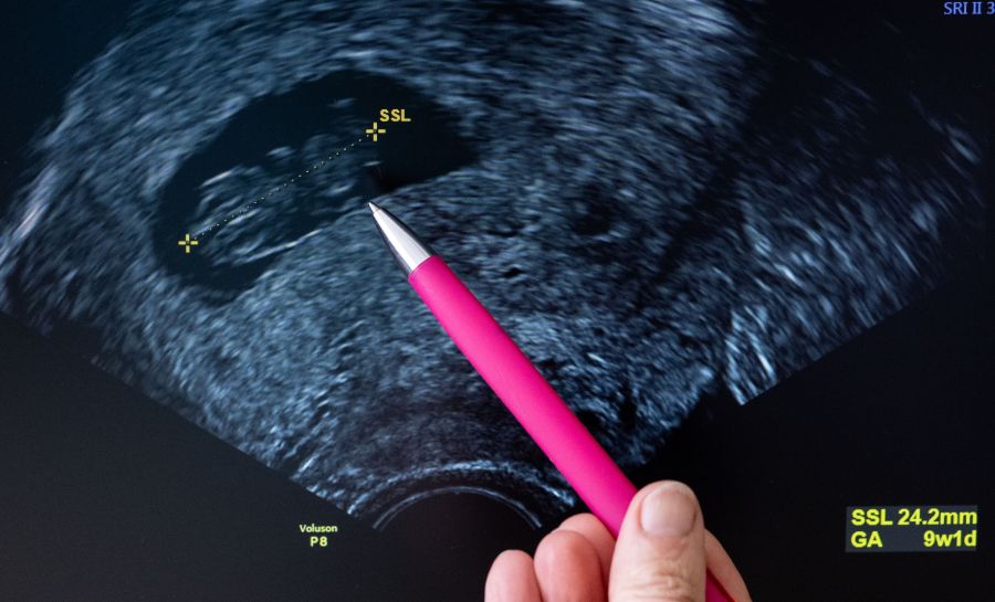 Mit 43 Jahren wurde die Frau aus dem US-Bundesstaat Nevada schliesslich erneut schwanger. (Archivbild)