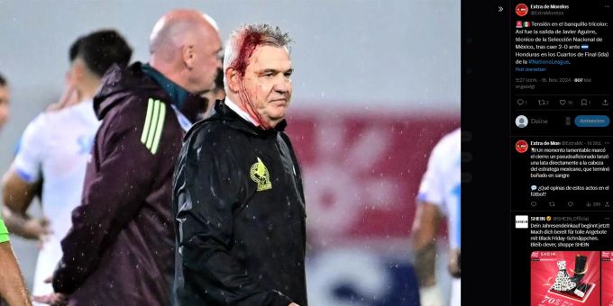 Unschöne Bilder in der Nations League: Aguirre wurde nach Schlusspfiff mit einer Bierdose am Kopf getroffen. Nations League