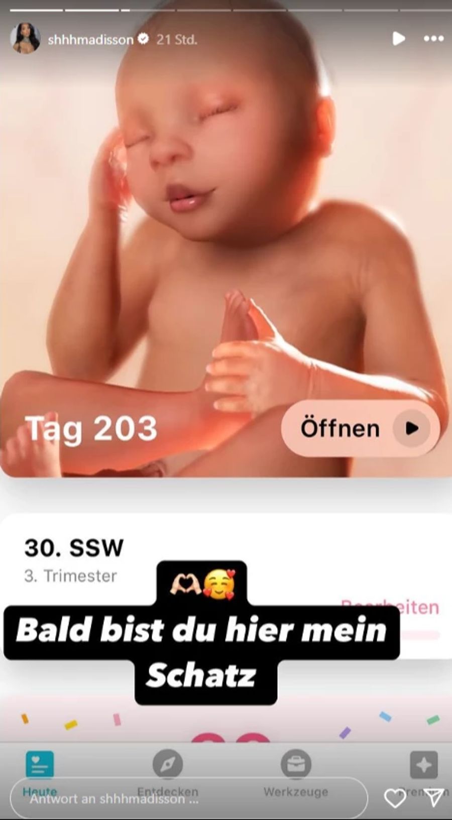 Die Zürcherin kann die Geburt ihres Babys kaum abwarten.