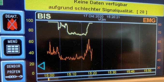 Im Rahmen von Blitzinduktionen werden die rationalen Hirngebiete selektiv sanft überreizt, was dazu führt, dass das Gehirn auf emotionaler und kreativer Ebene zugänglicher wird. Hypnose