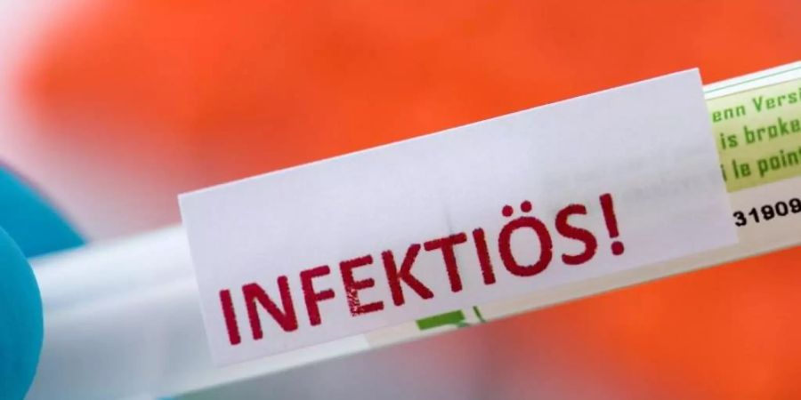 Eine Probe für ein Corona-Test in einem Diagnostik-Labor. Noch ist unklar, wie hoch die Zahl der Infizierten ist. Foto: Hendrik Schmidt/dpa/Symbolbild