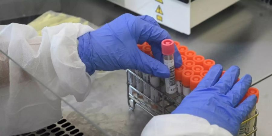 Karliczek: Corona-Impfstoff nicht vor Jahresende