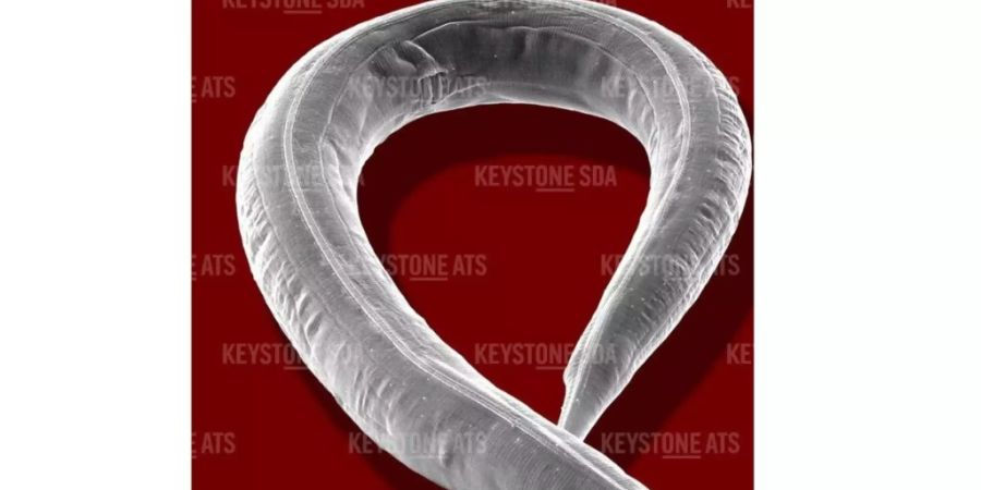 Dieser bescheidene Nematode (Fadenwurm) mit Namen Caenorhabditis elegans lehrt Forscher, wie man Komplexität reduziert. Sie haben nach seinem Vorbild ein Modell entwickelt, wie man die Unmengen an Anweisungen für Künstliche Intelligenz, beispielsweise in selbstfahrenden Autos, abkürzt. (Symbolbild)