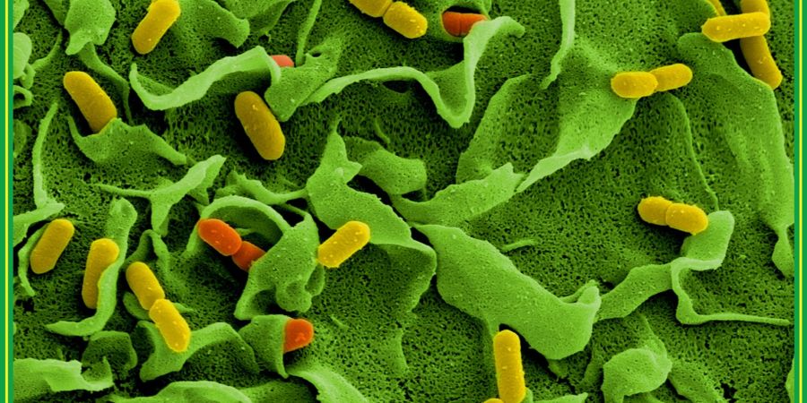 Elektronenmikroskopische Aufnahmen von Listerien (Listeria monocytogenes). Ein bayerisches Unternehmen ruft ihr Produkt «Bavaria blu Der Würzige 300g» zurück.