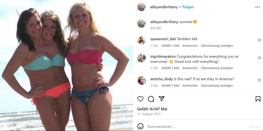 Abby und Brittany führen ein ganz normales Leben.