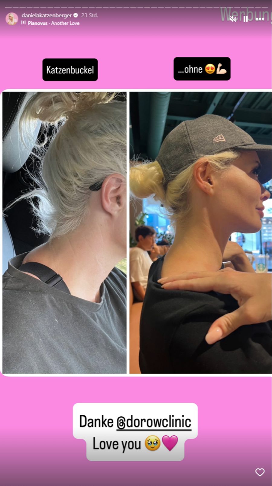 Daniela Katzenberger