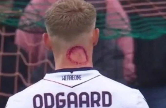 Diese Wunde von Jens Odgaard sorgt für Aufsehen. Bologna
