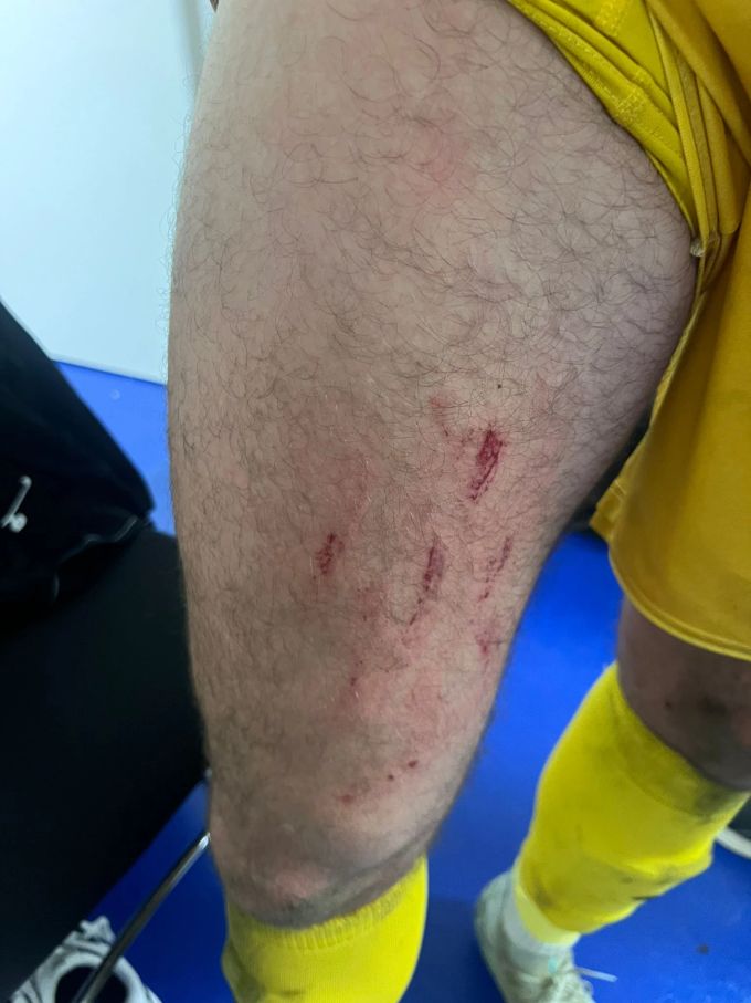 Das Bein von Winterthur-Keeper Kapino. FC Winterthur
