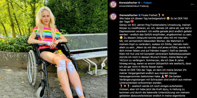 Theresia Fischer konnte das Krankenhaus nach ihrer Beinverlängerung im Rollstuhl verlassen. theresia fischer beinverlängerung