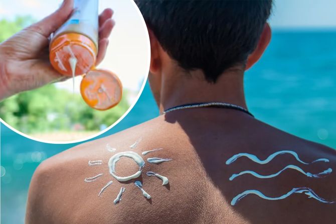 Sonnenschutz gehört in den Badeferien ins Gepäck – und kann je nach Ferienland überraschend teuer werden. - Adobe Stock