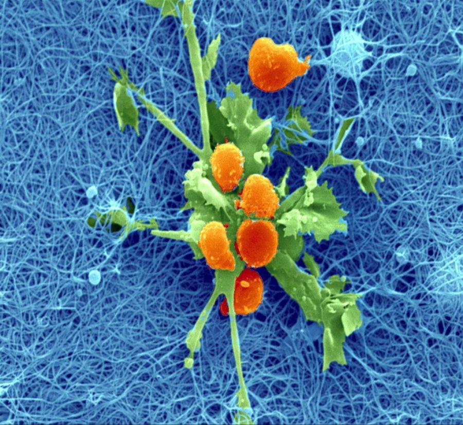 Die Tattoo-Tinte sammelt sich in grossen Mengen in den Lymphknoten an. Im Archivbild ein Lymphknoten einer Maus.