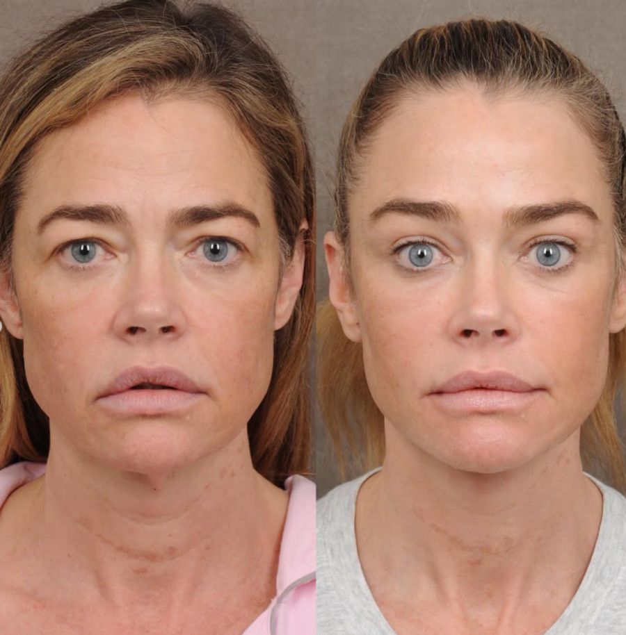 denise richards