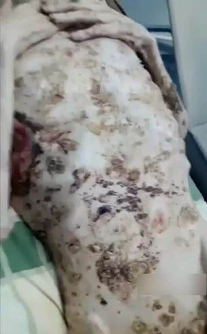 Der mit ausgetrocknetem Blut und Dreck überzogene Oberkörper von Alexander. Mann Russland Bär überlebt