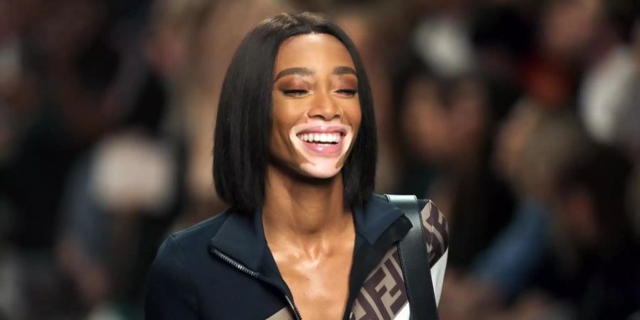 Heute kann Winnie Harlow ihre Krankheit weglachen.