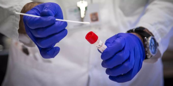 Über 20'000 Personen in der Schweiz haben sich mit dem Coronavirus infiziert. Coronavirus
