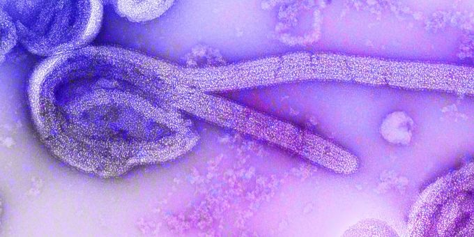 Eine elektronenmikroskopische Aufnahme des Marburg-Virus. Marburg-Virus