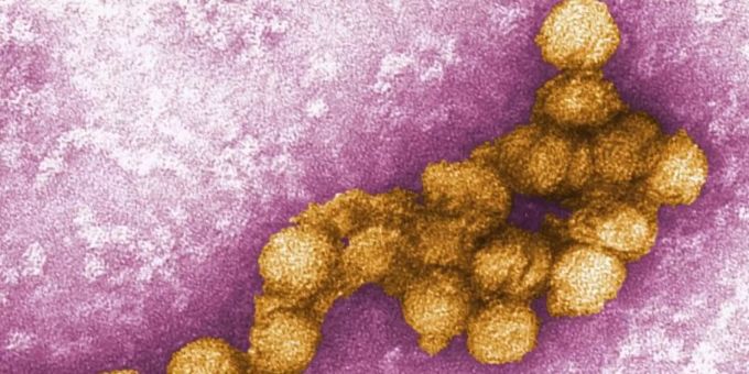 Das West-Nil-Virus unter dem Elektronenmikroskop. Erstmals ist in Deutschland eine durch Mücken übertragene Infektion beim Menschen nachgewiesen geworden. Foto: Cynthia Goldsmith/Centers For Disease Control/EPA West-Nil-Virus