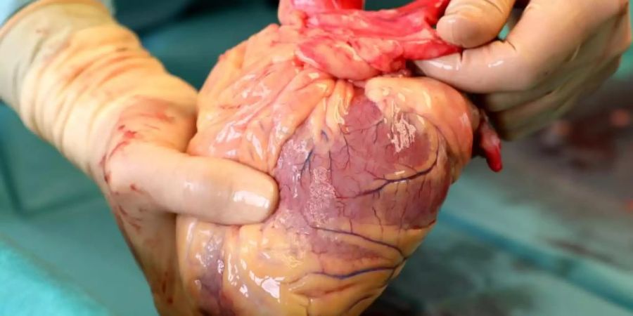 Ein Transplantationsmediziner hält in der Pathologie des Südstadt-Klinikums ein Herz in den Händen. Foto: Bernd Wüstneck