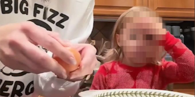 Auf Tiktok gibt es zahlreiche Videos, in denen Eltern ein rohes Ei auf der Stirn ihrer Kinder aufschlagen. Tiktok Trend Ei