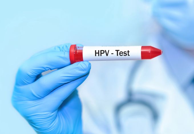 Gebärmutterhalskrebs wird durch Humane Papilloviren (HPV) verursacht. Frauengesundheit