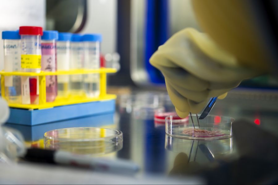 Eine Studie hat nun untersucht, welche Patientinnen und Patienten besonders gefährdet sind, eine solche Infektion zu entwickeln.