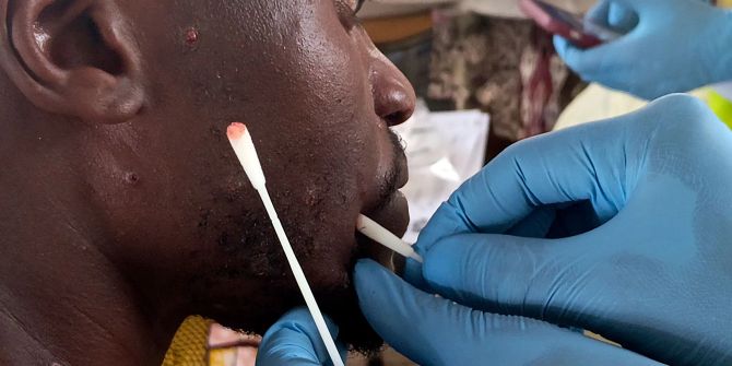Mpox