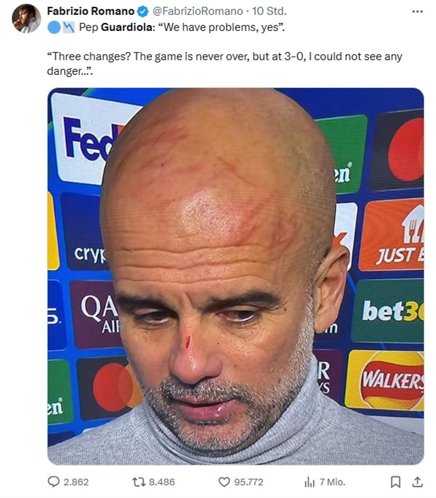 Pep Guardiola