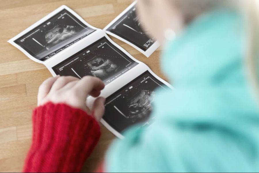 Nau.ch-Leserin Tamara Arnold erzählt: «Manchmal hatte ich Panik» wegen unüberlegter Ärzte-Aussagen über ihr Baby. (Symbolbild)