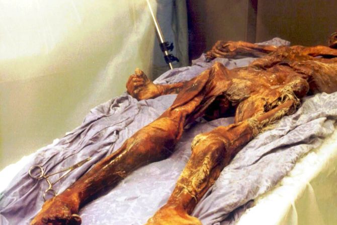 Körper Ötzi