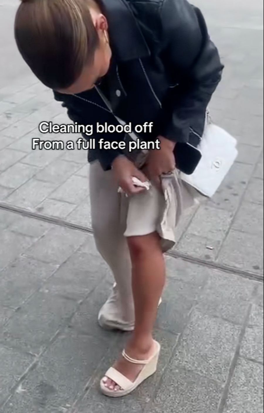knie