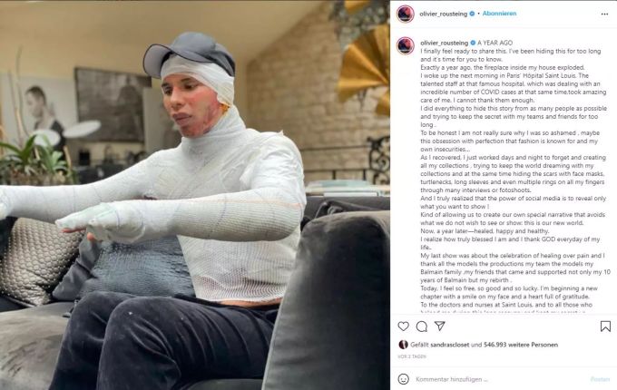 Vor drei Tagen postete der Modeschöpfer Olivier Rousteing erstmals ein Foto von den Bandagen nach dem Brandunfall. Olivier Rousteing bandagiert